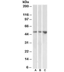 Western blot testing of kidney [A], testis [B] and uterus [C] lysates with KIM-1 antibody at 2ug/ml. Predicted molecular weight~39kDa, observed at ~55kDa.