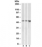 Western blot testing of kidney [A], testis [B] and uterus [C] lysates with KIM-1 antibody at 2ug/ml. Predicted molecular weight~39 kDa, routinely observed at ~55 kDa (Ref 1), and a heavily glycosylated mature form at ~100 kDa (Ref 2).