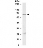 Western blot testing of HeLa lysate with TBK1 antibody at 1ug/ml. The expected ~85kDa band and the additional ~24kDa band are both blocked by the immunizing peptide.