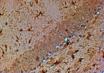 IHC testing of FFPE mouse hippocampus with TRPM7 antibody at 4ug/ml. HIER: steamed with pH6 or pH9 citrate buffer, HRP-staining.