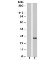Western blot of HEK293 lysate overexpressing BDH2 probed with BDH2 antibody (mock transfection in lane 1). Predicted molecular weight: ~27 kDa.