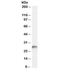 Western blot testing of human kidney lysate with BDH2 antibody at 0.3ug/ml. Predicted molecular weight: ~27kDa.