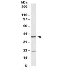 Western blot testing of Daudi lysate with KLHDC8B antibody at 0.5ug/ml. The expected ~38kDa band and the additional ~22kDa band are both blocked by the immunizing peptide.