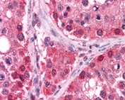 IHC testing of FFPE human testis tissue with TXNRD1 antibody at 2.5ug/ml. Required HIER: steamed antigen retrieval with pH6 citrate buffer; AP-staining.