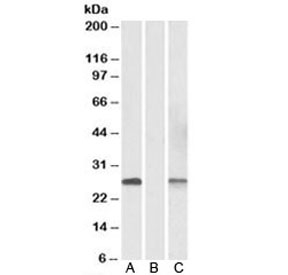 Western blot of HEK293 lysate overexpressing human DYDC1-MYC lysate (Lane A) and mock-transfected lysate (Lane B) with DYDC1 antibody at 1ug/ml. Lane C - same transfected lysate tested with anti-MYC tag (1:1000). Predicted molecular weight: ~21/22kDa (isoforms 1/2).~