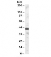 Western blot testing of human testis lysate with TFEC antibody at 1ug/ml. Predicted molecular weight: ~39kDa.