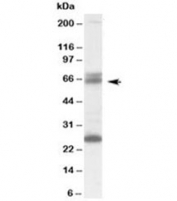 Western blot testing of human brain lysate with GAD65 antibody at 0.1ug/ml. The expected ~65kDa band and the additional ~26kDa band are both blocked by the immunizing peptide.