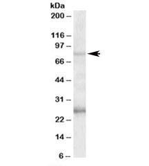 Western blot testing of human hippocampus lysate with GPRIN3 antibody at 1ug/ml. The expected ~80kDa band and the additional ~26kDa band are both blocked by the immunizing peptide.