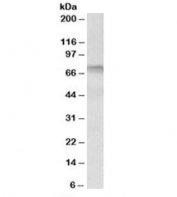 Western blot testing of human tonsil lysate with Transglutaminase 3 antibody at 0.3ug/ml. Predicted/observed molecular weight: ~77kDa.