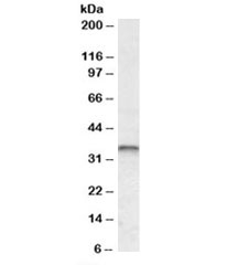 Western blot testing of human breast cancer lysate with JUNB antibody at 0.3ug/ml. Predicted molecular weight: ~36kDa.