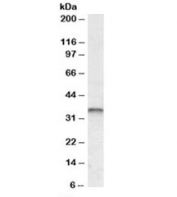 Western blot testing of human breast cancer lysate with JUNB antibody at 0.3ug/ml. Expected molecular weight: 36-39 kDa (non-phophorylated), 40-45 kDa (phosphorylated).