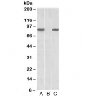 Western blot of HEK293 lysate overexpressing human STAT4-MYC probed with STAT4 antibody [1ug/ml] in Lane A and anti-MYC [1/1000] in lane C. Mock-transfected HEK293 probed with STAT4 antibody [1ug/ml] in Lane B. Predicted molecular weight: ~86kDa.