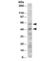 Western blot testing of HeLa lysate with TERF1 antibody at 2ug/ml. Predicted molecular weight: ~50/48kDa (isoforms 1/2), ~65kDa (possible acetylated form).