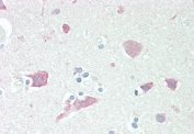 IHC staining of FFPE human cortex tissue with Neuroserpin antibody at 5ug/ml. Required HIER: steamed antigen retrieval with pH6 citrate buffer; AP-staining.