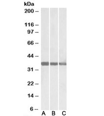 Western blot testing of human [A], mouse [B] and rat [C] heart lysate with MDH1 antibody at 0.01ug/ml. Predicted molecular weight: ~36kDa.~