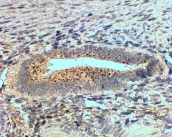 IHC staining of FFPE human uterus with SFRP4 antibody at 2ug/ml. HIER: steam