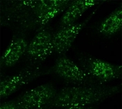 SNX1 antibody (5ug/ml) staining of formaldehyde-fixed SH5Y5Y cells detected with Alexa Fluor 488 in confocal microscopy.