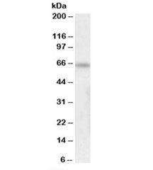 Western blot testing of human thymus lysate with FOXK2 antibody at 0.3ug/ml. Predicted molecular weight: ~69kDa (isoform 1).
