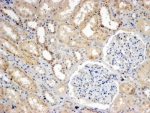 IHC testing of FFPE human kidney with SNX8 antibody at 4ug/ml. HIER: steamed with pH9 Tris/EDTA buffer, HRP-staining.