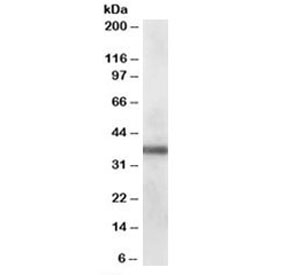 Western blot testing of human lung lysate with PDLIM1 antibody at 0.1ug/ml. Predicted molecular weight: ~36kDa.~