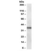 Western blot testing of human lung lysate with PDLIM1 antibody at 0.1ug/ml. Predicted molecular weight: ~36 kDa.