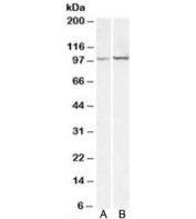 Western blot of mouse (A) and rat (B) spleen lysates with ACTN1 antibody at 0.3ug/ml. Predicted molecular weight: ~103kDa.