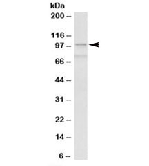 Western blot testing of human spleen lysate with ACTN1 antibody at 0.3ug/ml. Predicted molecular weight: ~103kDa. Both observed bands are blocked by addition of immunizing peptide.~