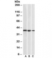Western blot of NIH3T3 (A), mouse testis (B) and rat testis (C) lysates with TBP antibody at 1ug/ml. Predicted molecular weight ~38kDa.
