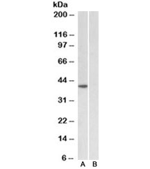 Western blot testing of HeLa nuclear [A] and cytosolic [B] lysates with TBP antibody at 1ug/ml. Predicted molecular weight ~38kDa.
