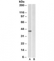 Western blot testing of HeLa nuclear [A] and cytosolic [B] lysates with TBP antibody at 1ug/ml. Predicted molecular weight ~38kDa.