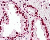 IHC staining of FFPE human prostate tissue with IRF6 antibody at 2.5ug/ml. HIER: steamed with pH6 citrate buffer, AP-staining.