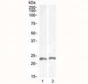 Western blot testing of 1) mouse colon and 2) rat colon lysate with LIF antibody at 0.5ug/ml. Observed molecular weight ~23 kDa (unmodified), 32~62 kDa (glycosylated).