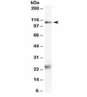 Western blot testing of rat brain lysate with NR1 antibody at 2ug/ml. Molecular weight: the expected ~110kDa band and the additional ~24kDa band are both blocked by the immunizing peptide.