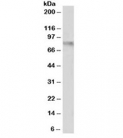 Western blot testing of human uterus lysate with VCAM antibody at 1ug/ml. Expected molecular weight: 74-80 kDa (unmodified), 100-110 kDa (glycosylated).