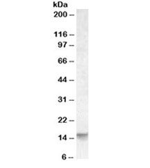 Western blot testing of human cerebellum lysate with Noxa antibody at 0.03ug/ml. Predicted molecular weight ~6/15kDa (isoform 1/2).