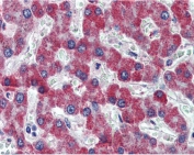 IHC testing of FFPE human liver tissue with PAR1 antibody at 2.5ug/ml. Required HIER: steamed antigen retrieval with pH6 citrate buffer; AP-staining.