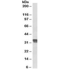 Western blot testing of human placenta lysate with Cyclin D1 antibody at 0.5ug/ml. Predicted molecular weight ~34kDa.