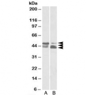 Western blot testing of A) HeLa and B) human colon cancer lysate with TIP47 antibody at 0.03ug/ml. Image shows isoforms 1-3 being detected.