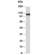 Western blot testing of human thyroid gland lysate with Thyroid Peroxidase antibody at 0.3ug/ml. Predicted molecular weight ~103kDa.~