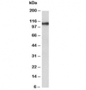 Western blot testing of human thyroid gland lysate with Thyroid Peroxidase antibody at 0.3ug/ml. Predicted molecular weight ~103 kDa but may be observed at higher molecular weights due to glycosylation.