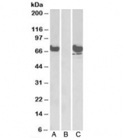 Western blot of HEK293 lysate overexpressing human EPM2AIP1-FLAG probed with EPM2AIP1 antibody [1ug/ml] in lane A and anti-FLAG [1/1000] in lane C. Mock-transfected HEK293 probed with EPM2AIP1 antibody [1ug/ml] in lane B. Predicted/observed molecular weight: ~70kDa.