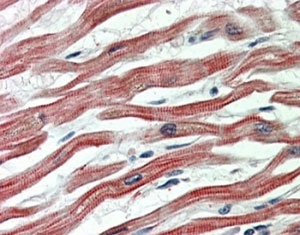 IHC staining of FFPE human heart with EPM2AIP1 antibody at 5ug/ml. HIER: steamed with pH6 citrate buffer, AP-staining.~