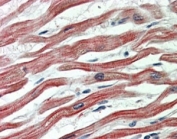 IHC staining of FFPE human heart with EPM2AIP1 antibody at 5ug/ml. HIER: steamed with pH6 citrate buffer, AP-staining.