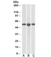 Western blot testing of human breast [A], placenta [B] and spleen [C] lysates with ENT1 antibody at 1ug/ml. Predicted molecular weight: ~50kDa.