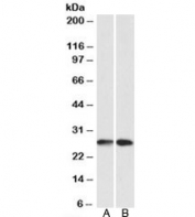 Western blot testing of A549 [A] and HeLA [B] lysates with NNMT antibody at 0.1ug/ml. Predicted molecular weight: ~29kDa.
