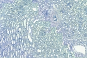 Negative control: IHC staining of FFPE human kidney tissue without primary antibody. Required HIER: steamed antigen retrieval with pH6 citrate buffer; HRP-staining.