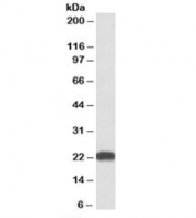 Western blot testing of human liver lysate with BLVRB antibody at 0.3ug/ml. Predicted molecular weight: ~22kDa.