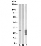 Western blot of HEK293 lysate overexpressing human GM2A-FLAG probed with GMA2 antibody (1ug/ml) in Lane A and anti-FLAG (1/30000) in lane C. Mock-transfected HEK293 probed with GMA2 antibody (1ug/ml) in Lane B. Predicted molecular weight ~22kDa.
