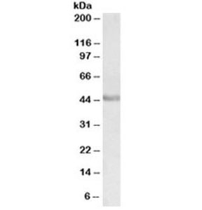 Western blot testing of human duodenum lysate with PAX3 antibody at 0.3ug/ml. Predicted molecular weight: can detect 7 isoforms ranging from 22~56kDa.~