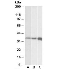 Western blot testing of A) human, B) mouse and C) rat skeletal muscle lysates with TNNT3 antibody at 0.01ug/ml. Predicted molecular weight: ~32kDa, routinely observed at 35~38kDa.~